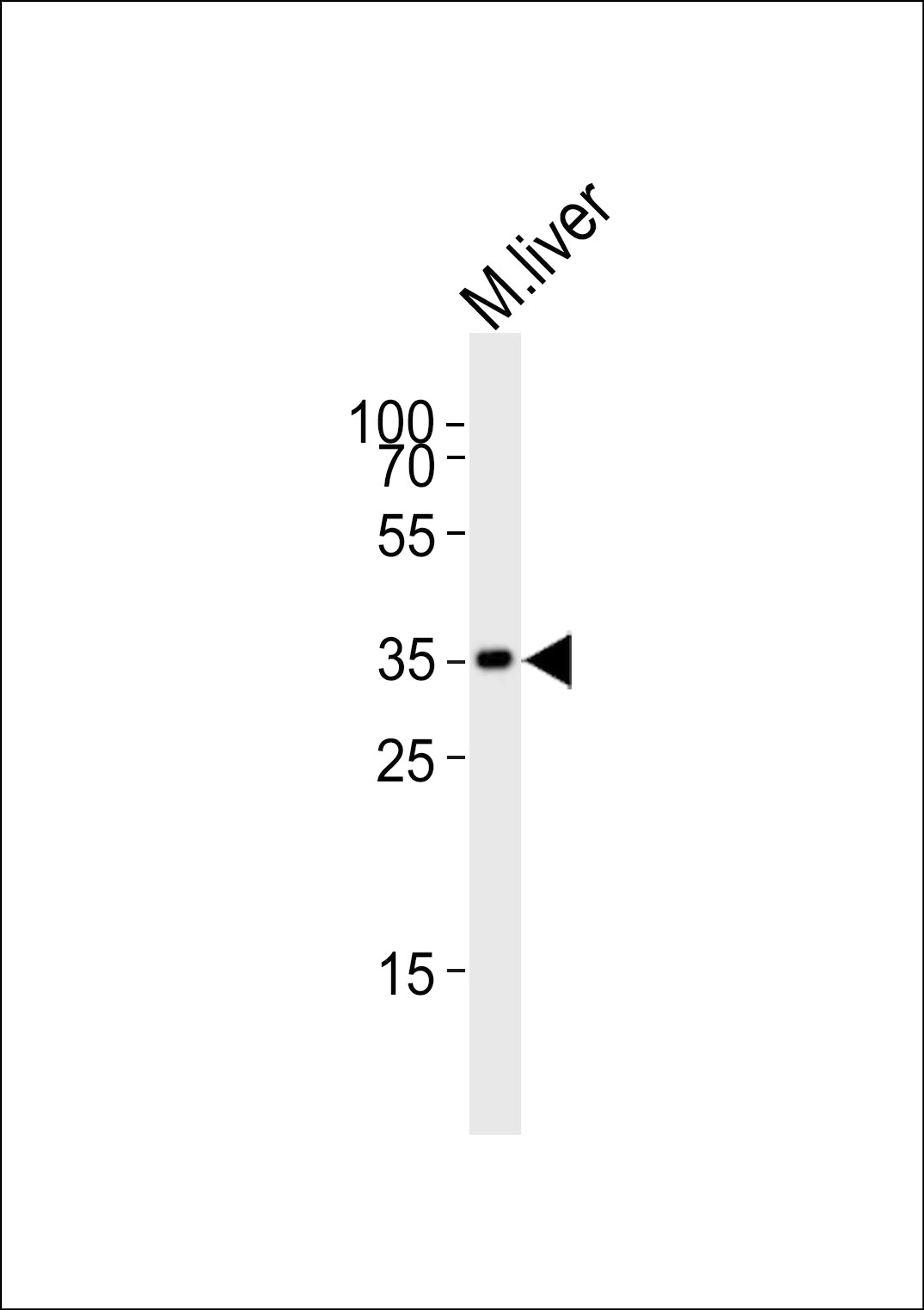 Western blot analysis of lysate from mouse liver tissue lysate, using Hmx2 Antibody at 1:1000.