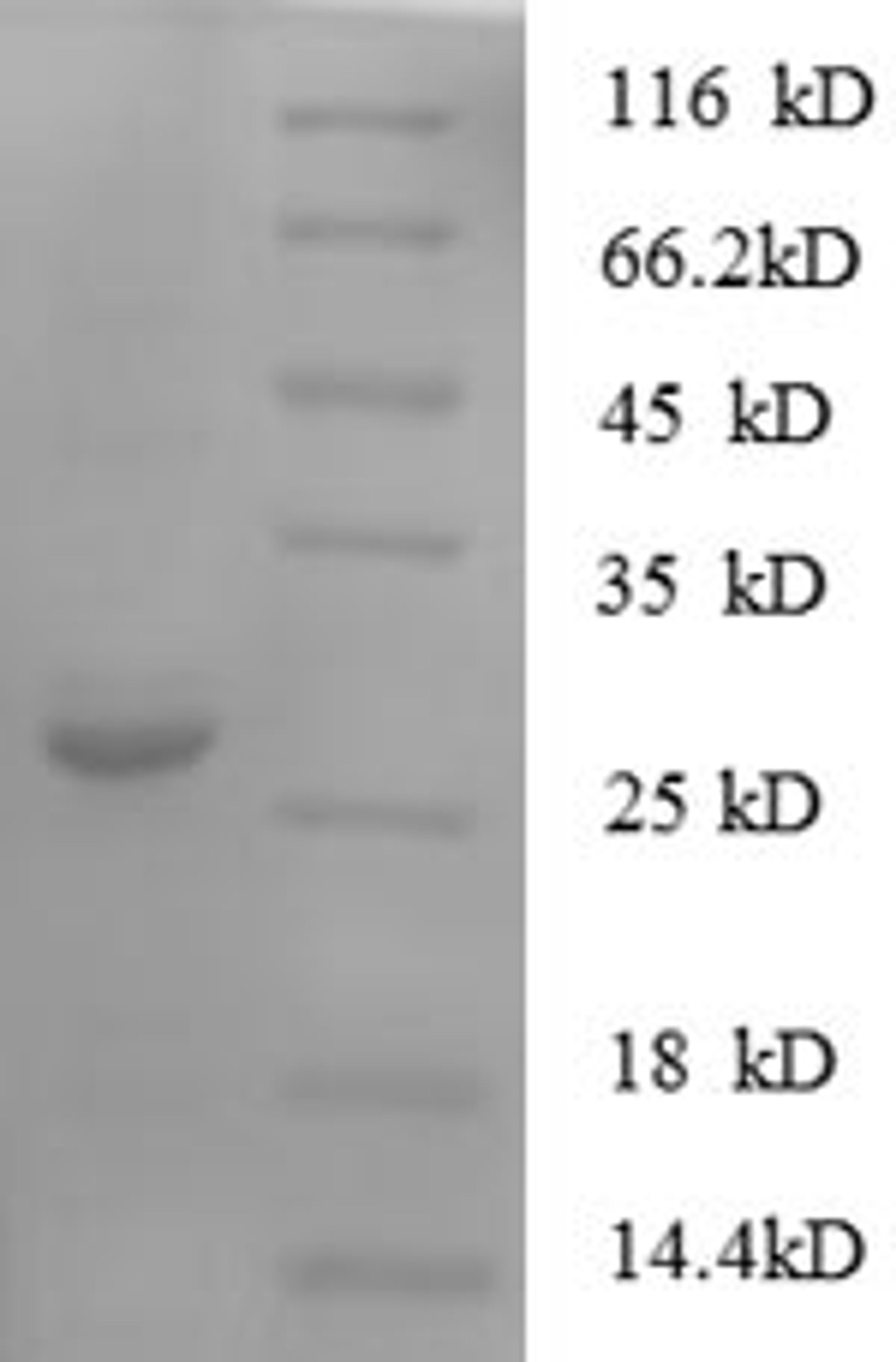(Tris-Glycine gel) Discontinuous SDS-PAGE (reduced) with 5% enrichment gel and 15% separation gel.