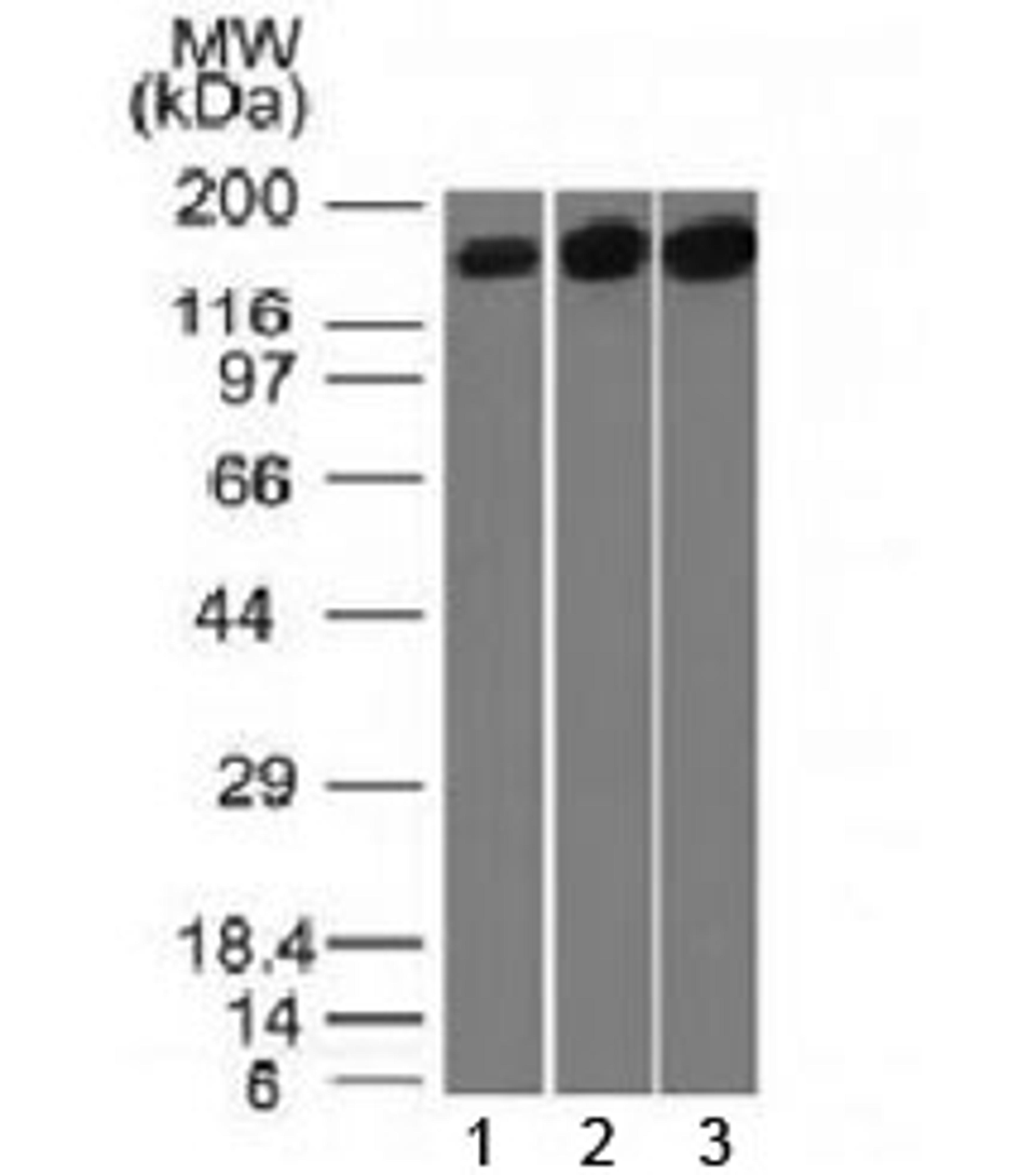 Western blot testing of 1) human HepG2, 2) HeLa and 3) mouse NIH3T3 cell lysate with Topoisomerase II alpha antibody (clone TOP2A/1361). Expected molecular weight ~174 kDa.