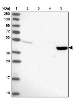 Western Blot: TMEM44 Antibody [NBP1-90507] - Lane 1: Marker [kDa] 250, 130, 95, 72, 55, 36, 28, 17, 10<br/>Lane 2: Human cell line RT-4<br/>Lane 3: Human cell line U-251MG sp<br/>Lane 4: Human plasma (IgG/HSA depleted)<br/>Lane 5: Human liver tissue