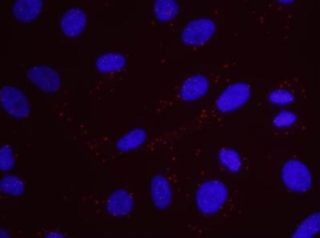 Proximity Ligation Assay: RFC1 Antibody [NB100-230] - Secondary-conjugate Duolink II PLA in Hela cells. goat anti-human RFC1 (NB100-230) and rabbit anti-human BLM (NB100-214). Image merged from DAPI (2ms) and Texas Red (200ms) exposures, 40X magnification.