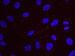 Proximity Ligation Assay: RFC1 Antibody [NB100-230] - Secondary-conjugate Duolink II PLA in Hela cells. goat anti-human RFC1 (NB100-230) and rabbit anti-human BLM (NB100-214). Image merged from DAPI (2ms) and Texas Red (200ms) exposures, 40X magnification.