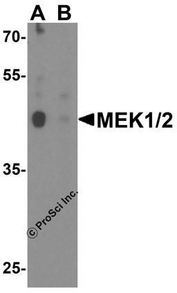 Western blot analysis of MEK1/2 in human brain tissue lysate with MEK1/2 antibody at 1 μg/ml in (A) the absence and (B) the presence of blocking peptide.