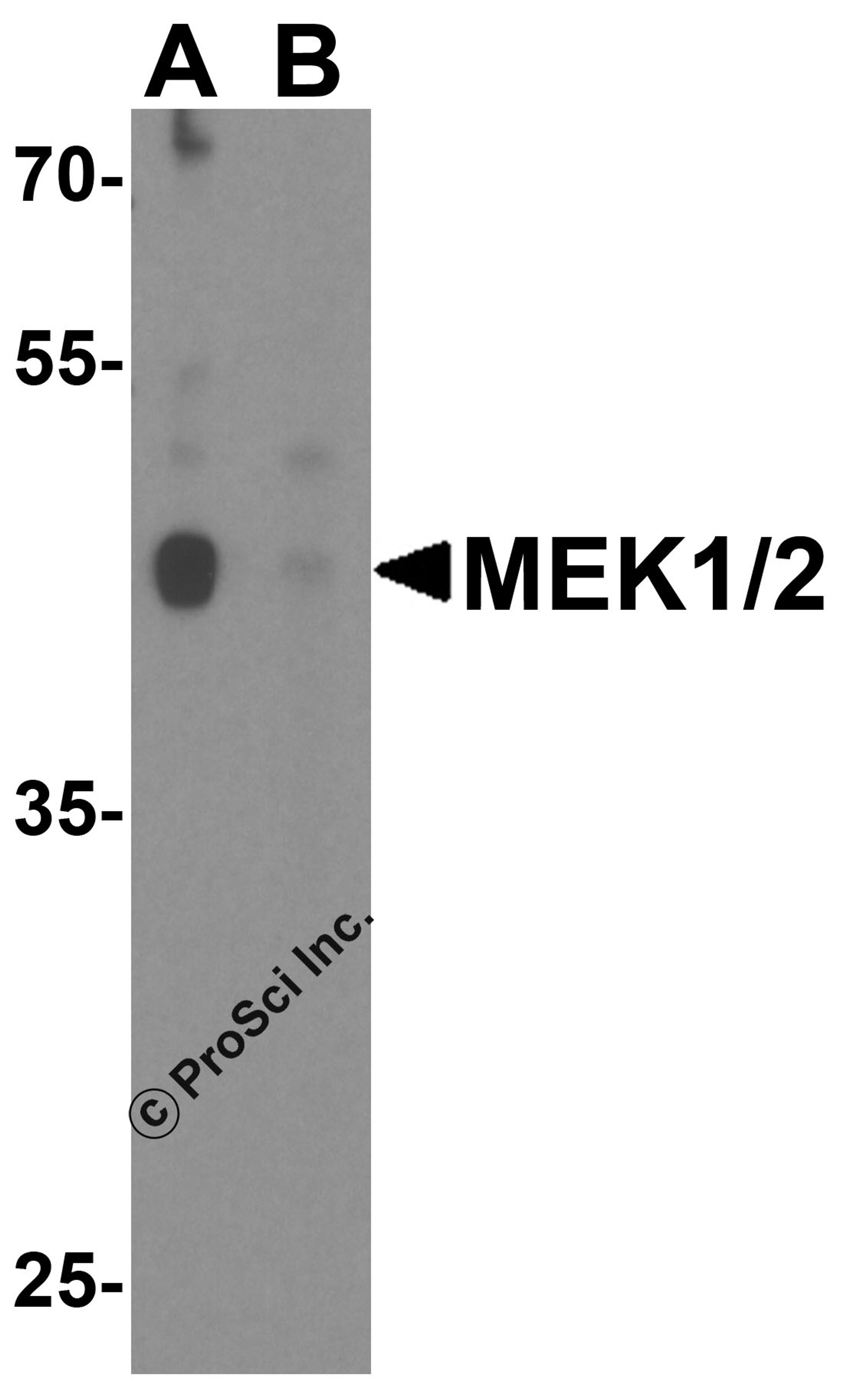 Western blot analysis of MEK1/2 in human brain tissue lysate with MEK1/2 antibody at 1 μg/ml in (A) the absence and (B) the presence of blocking peptide.