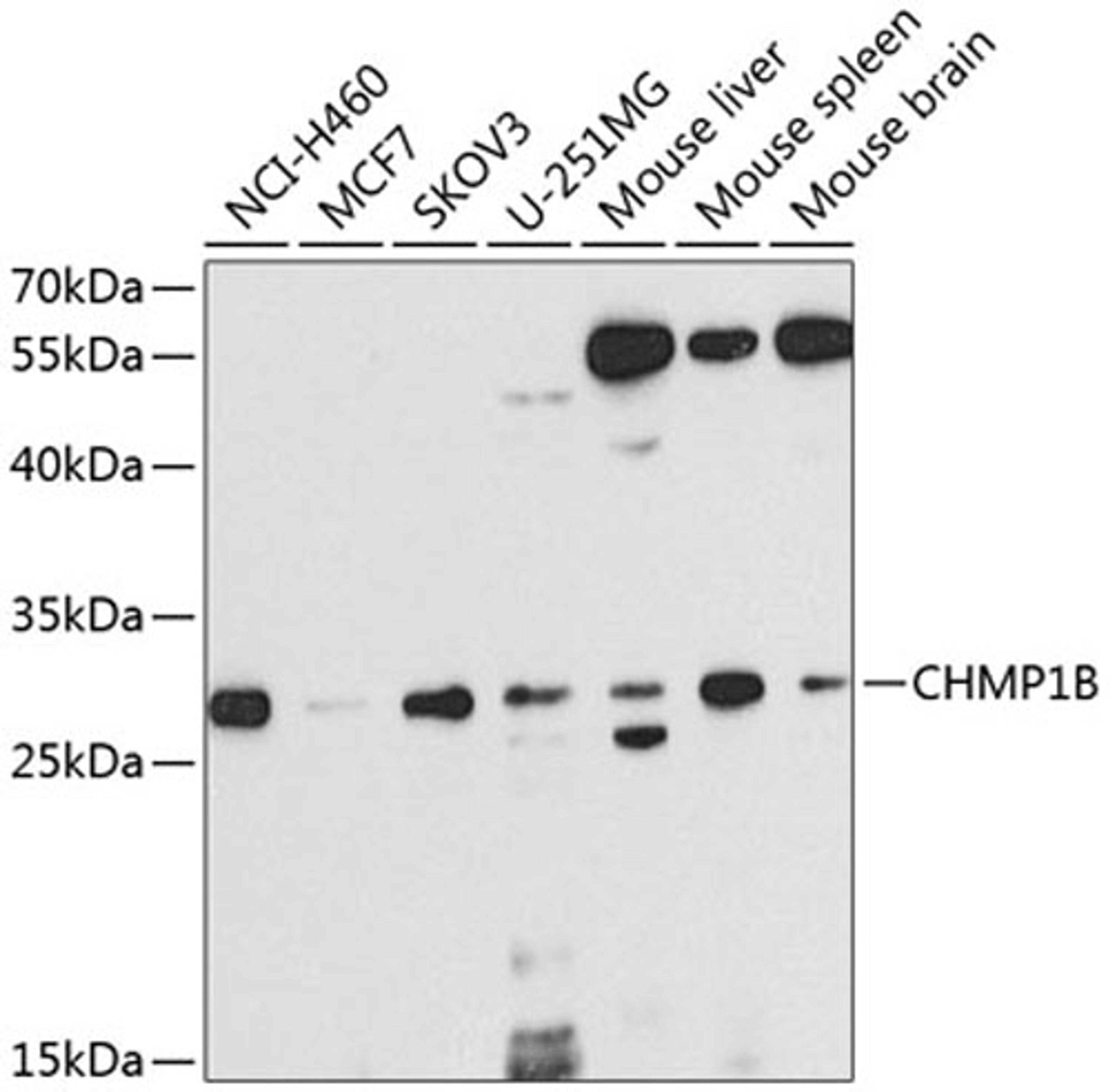 Western blot - CHMP1B antibody (A8239)