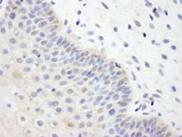 Detection of human UBCH7 by immunohistochemistry.