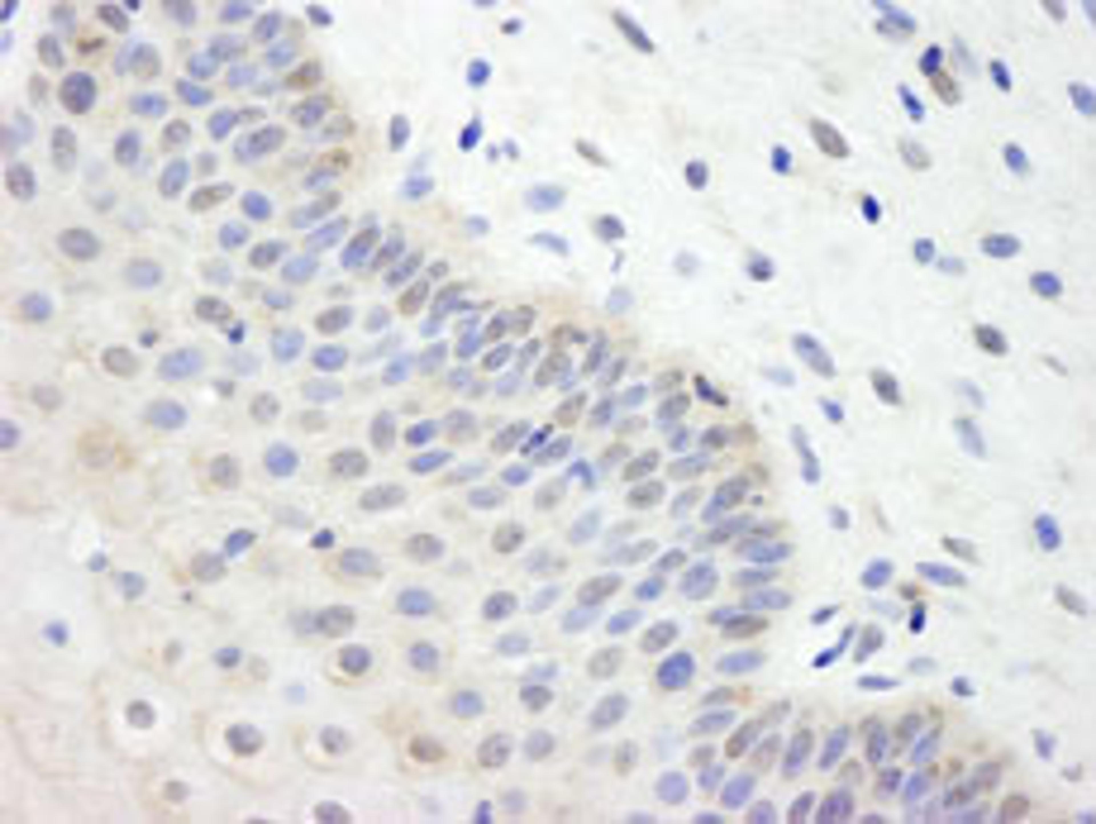 Detection of human UBCH7 by immunohistochemistry.