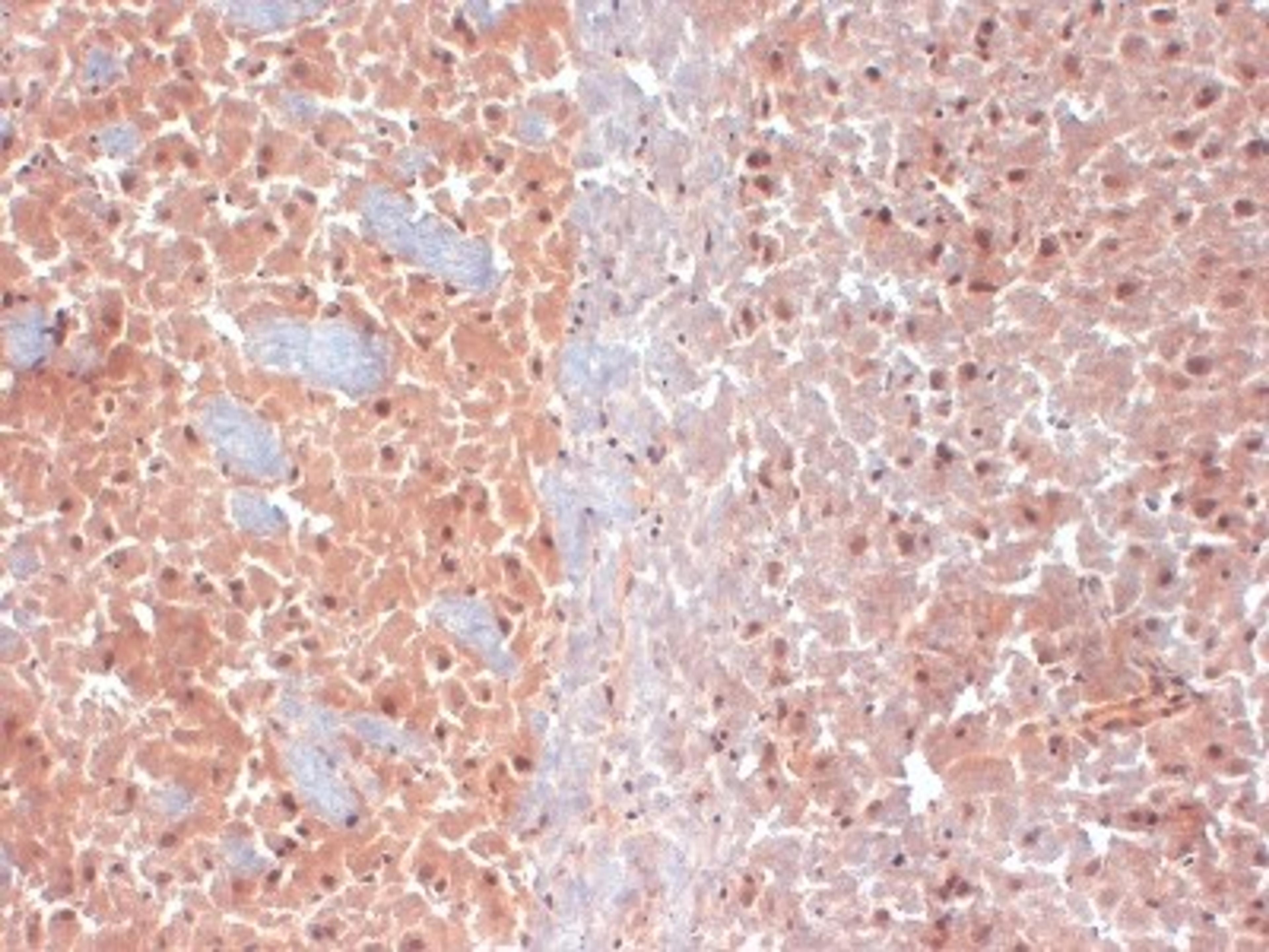 Immunohistochemistry-Frozen: KCNQ4 Antibody (S43-6) [NBP2-12899] - frozen sections of mouse brain using this antibody.