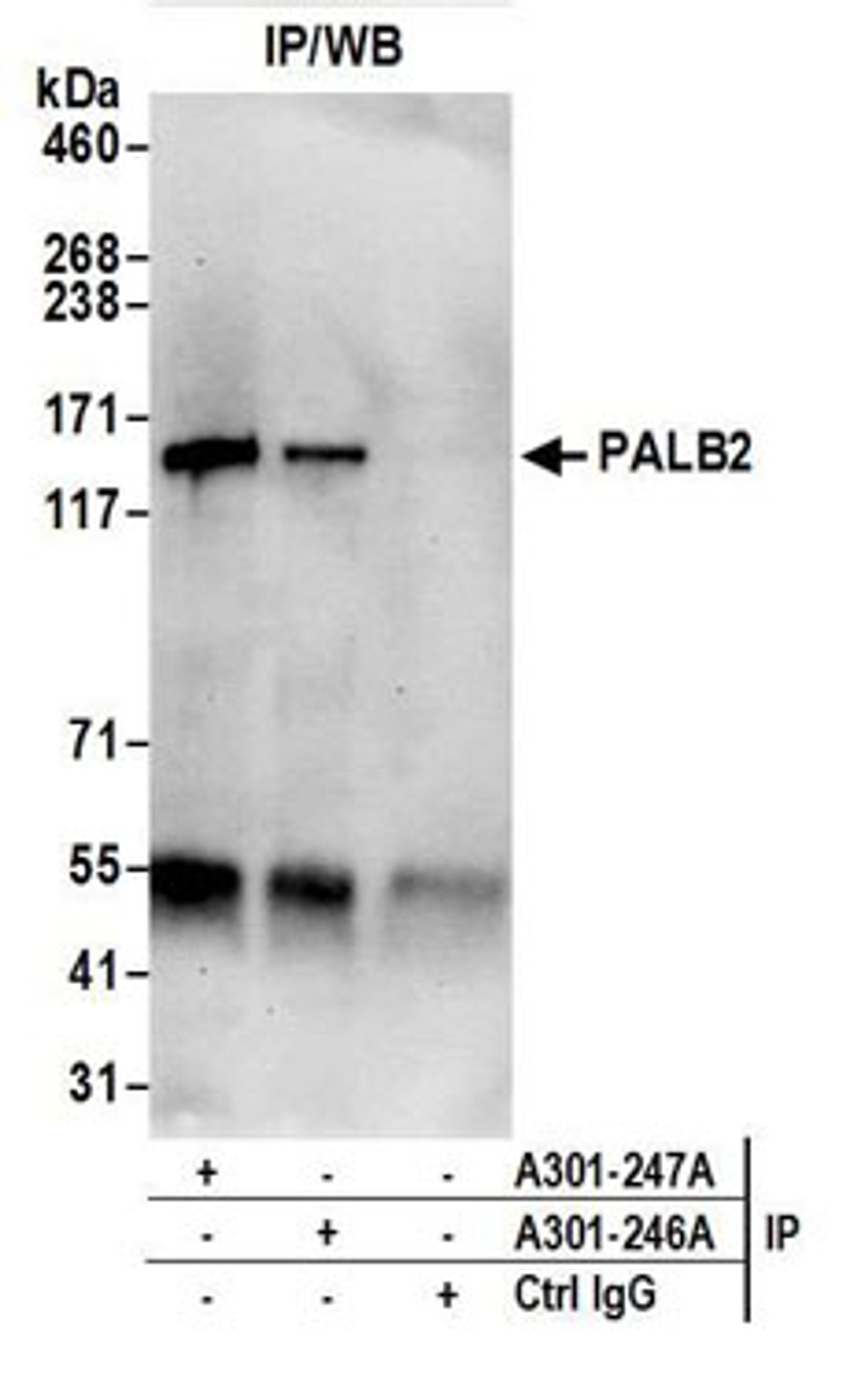 Detection of human PALB2 by western blot of immunoprecipitates.