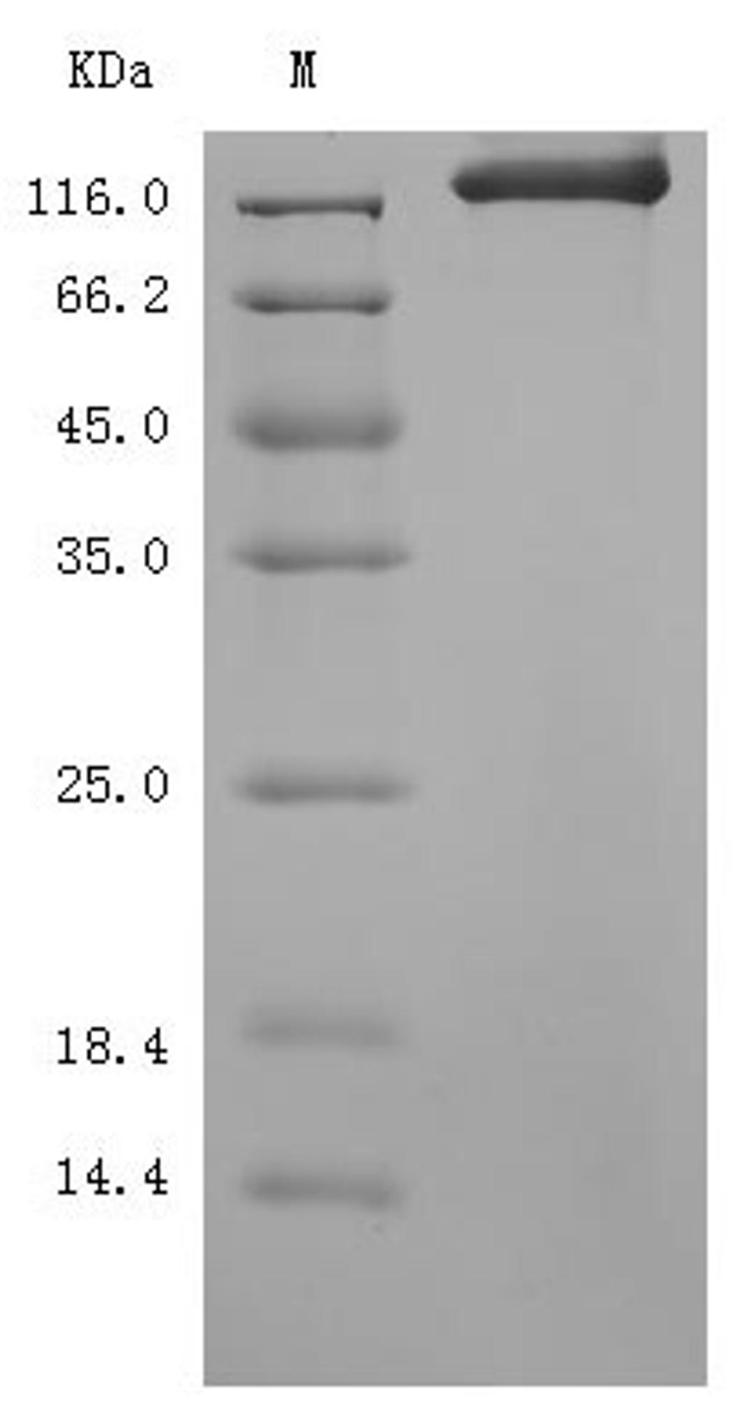 (Tris-Glycine gel) Discontinuous SDS-PAGE (reduced) with 5% enrichment gel and 15% separation gel.