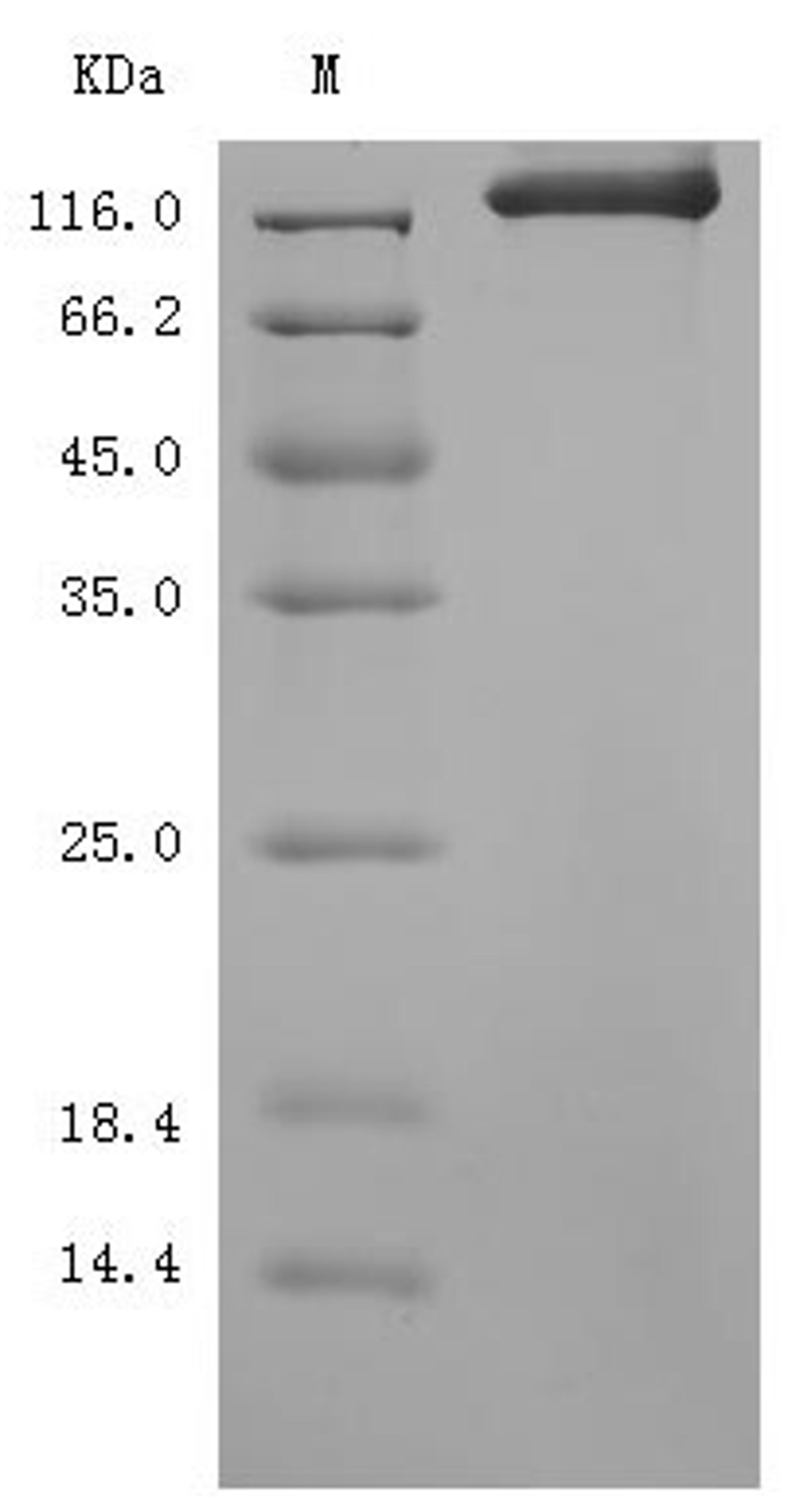(Tris-Glycine gel) Discontinuous SDS-PAGE (reduced) with 5% enrichment gel and 15% separation gel.