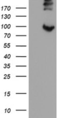 Western Blot: LEPRE1 Antibody (1H3) [NBP2-45786] - Analysis of HEK293T cells were transfected with the pCMV6-ENTRY control (Left lane) or pCMV6-ENTRY LEPRE1.