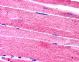 46-414 (2.5ug/ml) staining of paraffin embedded human skeletal muscle. Steamed antigen retrieval with citrate buffer pH 6, AP-staining.