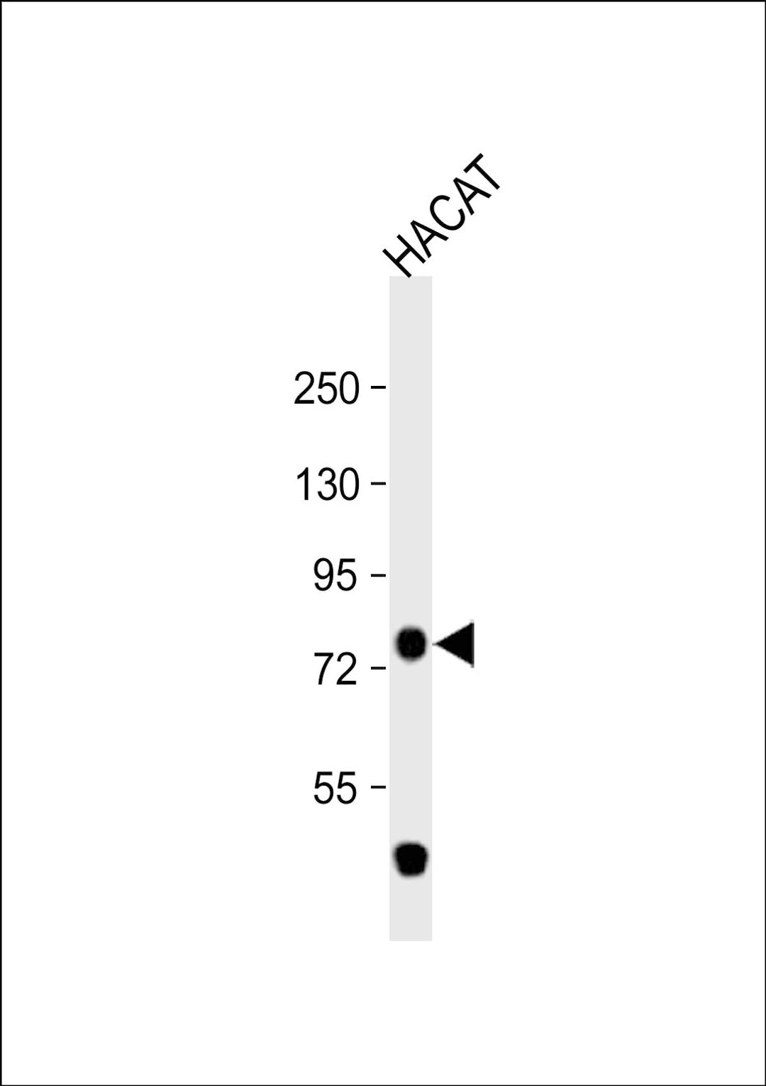 Western Blot at 1:1000 dilution + HACAT whole cell lysate Lysates/proteins at 20 ug per lane.