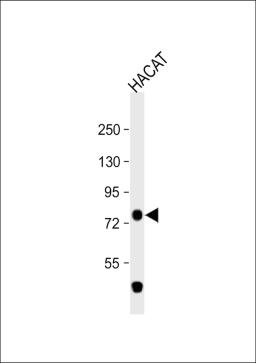 Western Blot at 1:1000 dilution + HACAT whole cell lysate Lysates/proteins at 20 ug per lane.