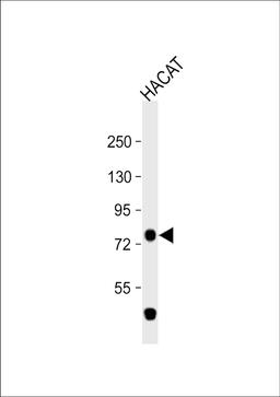 Western Blot at 1:1000 dilution + HACAT whole cell lysate Lysates/proteins at 20 ug per lane.