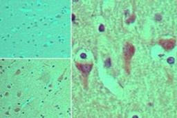 Immunohistochemistry-Paraffin: ACAP4 Antibody [NBP2-24666] - Analysis of ASAP3 in formalin-fixed, paraffin-embedded human brain tissue using an isotype control (top left) and this antibody (bottom left, right) at 5 ug/ml.