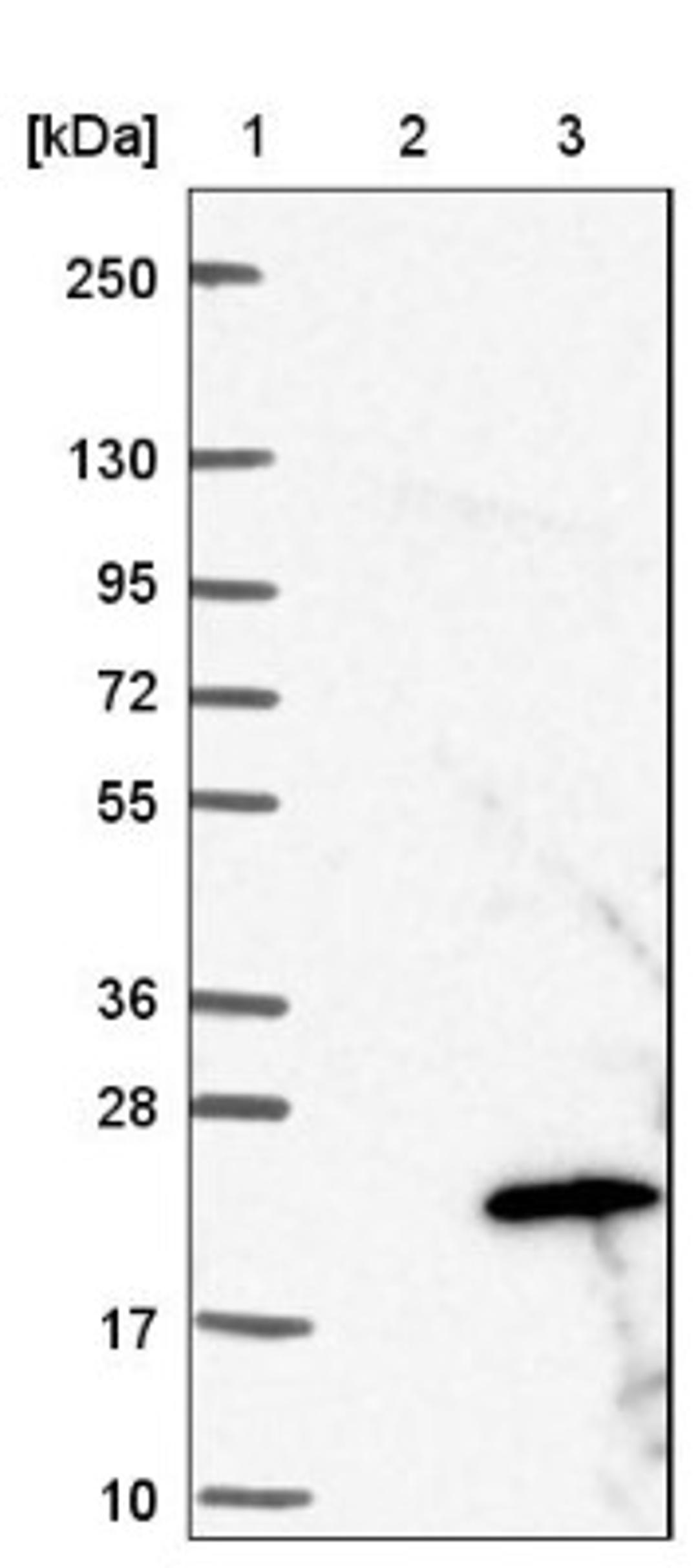 Western Blot: PRELID2 Antibody [NBP1-81937] - Lane 1: Marker [kDa] 250, 130, 95, 72, 55, 36, 28, 17, 10<br/>Lane 2: Negative control (vector only transfected HEK293T lysate)<br/>Lane 3: Over-expression lysate (Co-expressed with a C-terminal myc-DDK tag (~3.1 kDa) in mammalian HEK293T cells, LY408585)