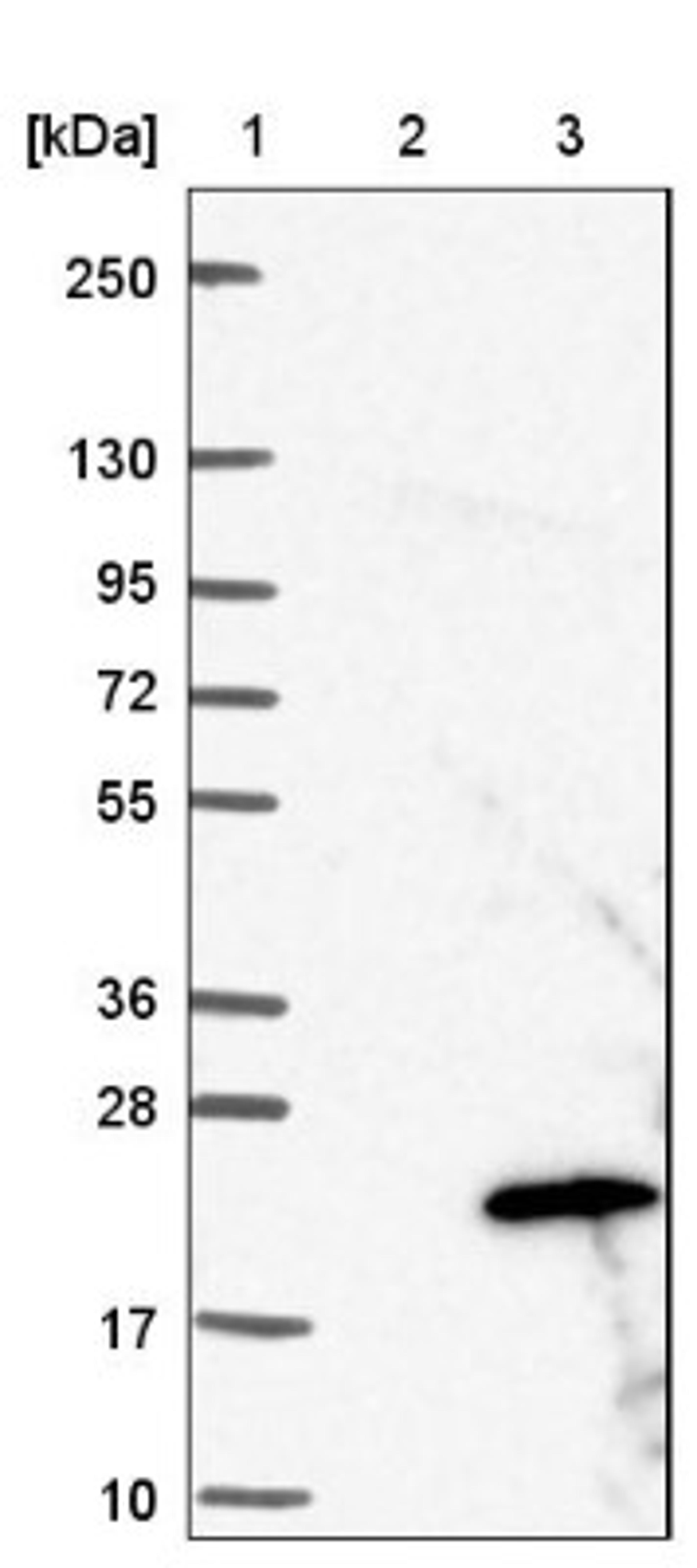 Western Blot: PRELID2 Antibody [NBP1-81937] - Lane 1: Marker [kDa] 250, 130, 95, 72, 55, 36, 28, 17, 10<br/>Lane 2: Negative control (vector only transfected HEK293T lysate)<br/>Lane 3: Over-expression lysate (Co-expressed with a C-terminal myc-DDK tag (~3.1 kDa) in mammalian HEK293T cells, LY408585)