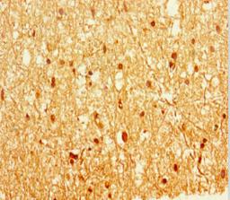 Immunohistochemistry of paraffin-embedded human brain tissue using CSB-PA007738LA01HU at dilution of 1:100