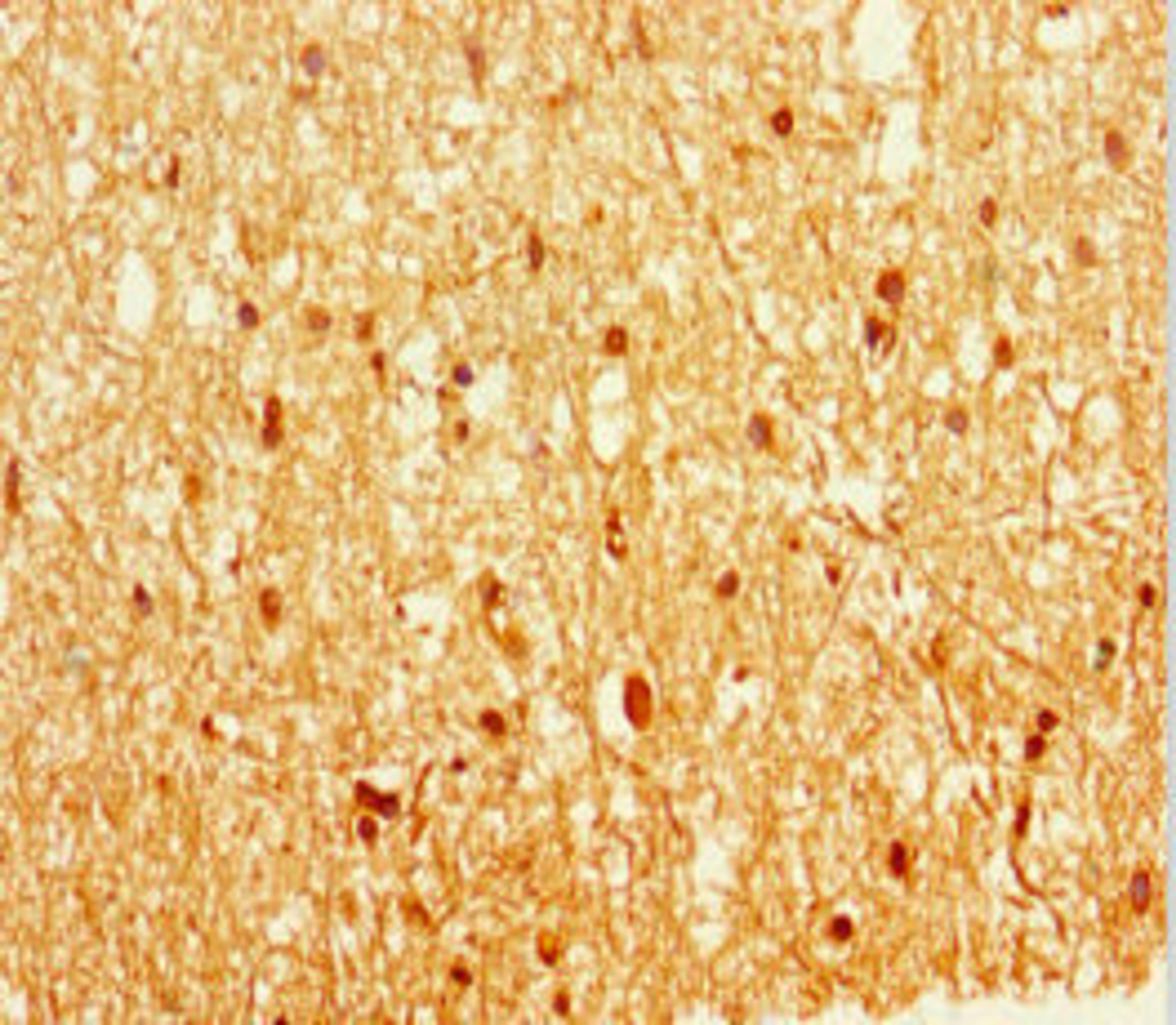 Immunohistochemistry of paraffin-embedded human brain tissue using CSB-PA007738LA01HU at dilution of 1:100