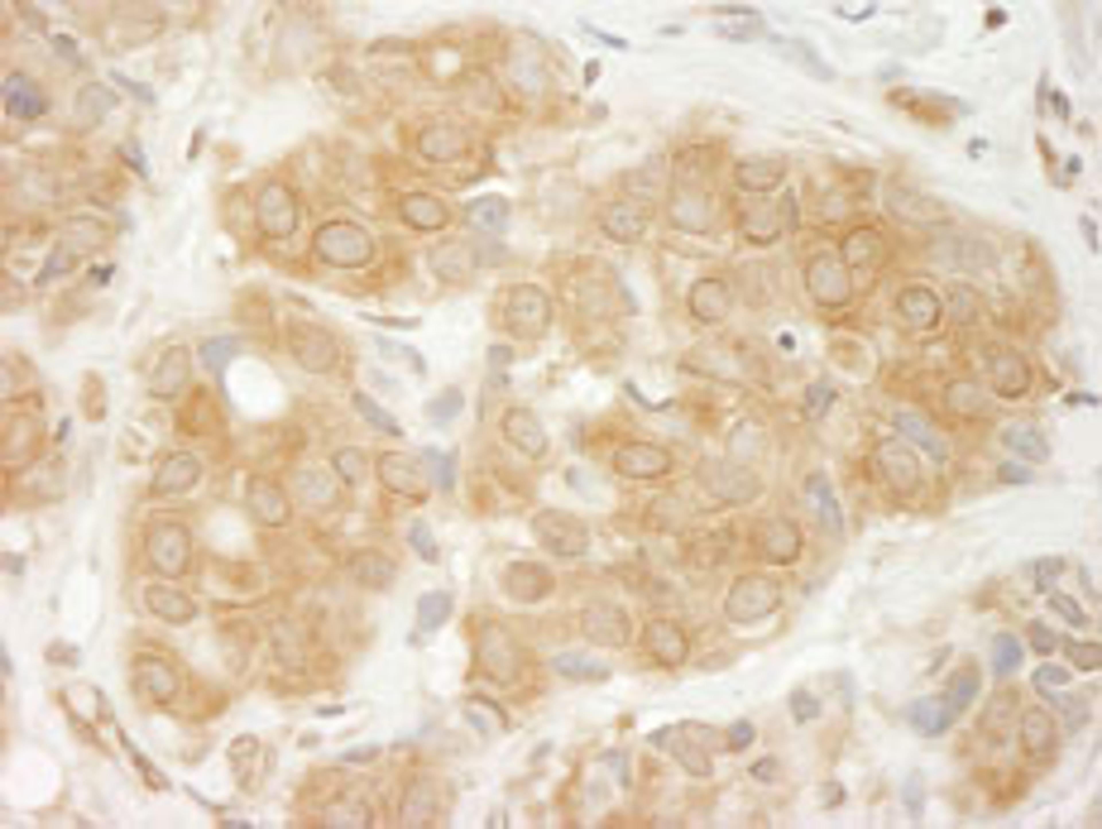 Detection of human GIT1 by immunohistochemistry.