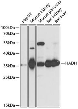 Western blot - HADH antibody (A1076)