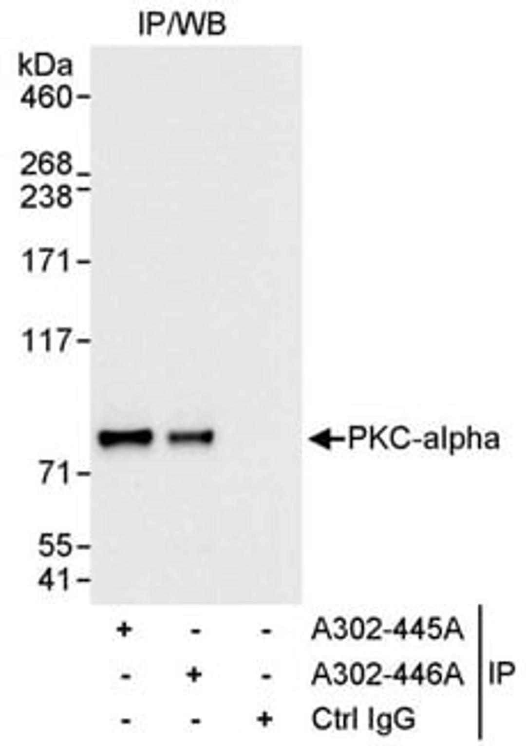 Detection of human PKC-alpha by western blot of immunoprecipitates.