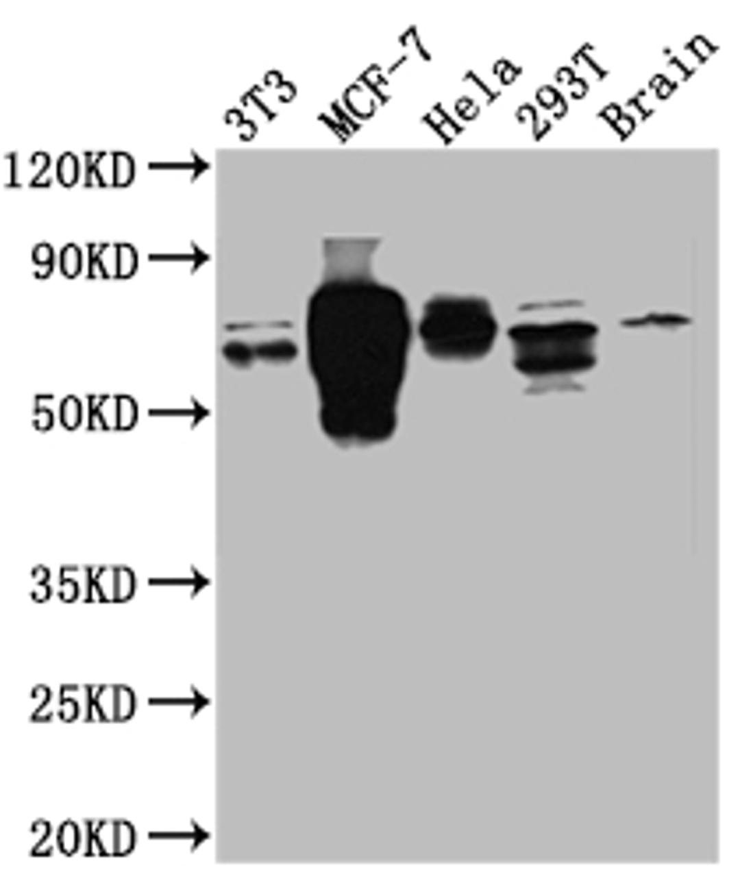 Western Blot. Positive WB detected in: NIH/3T3 whole cell lysate, MCF-7 whole cell lysate, Hela whole cell lysate, 293T whole cell lysate, Mouse Brain whole cell lysate. All lanes: S6K1 antibody at 1:1000. Secondary. Goat polyclonal to rabbit IgG at 1/50000 dilution. Predicted band size: 60, 57, 53, 57, 52 kDa. Observed band size: 70 kDa.