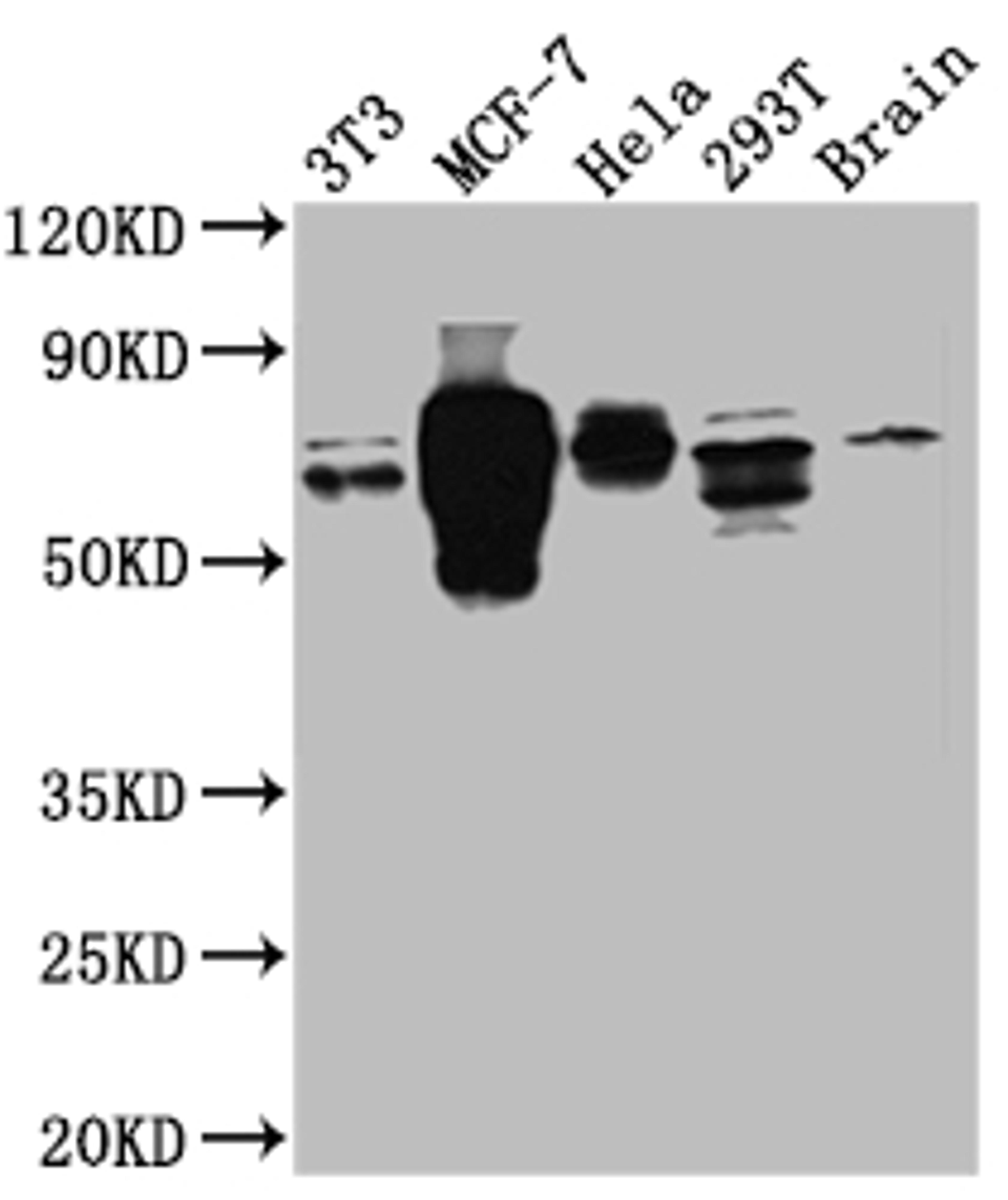 Western Blot. Positive WB detected in: NIH/3T3 whole cell lysate, MCF-7 whole cell lysate, Hela whole cell lysate, 293T whole cell lysate, Mouse Brain whole cell lysate. All lanes: S6K1 antibody at 1:1000. Secondary. Goat polyclonal to rabbit IgG at 1/50000 dilution. Predicted band size: 60, 57, 53, 57, 52 kDa. Observed band size: 70 kDa.