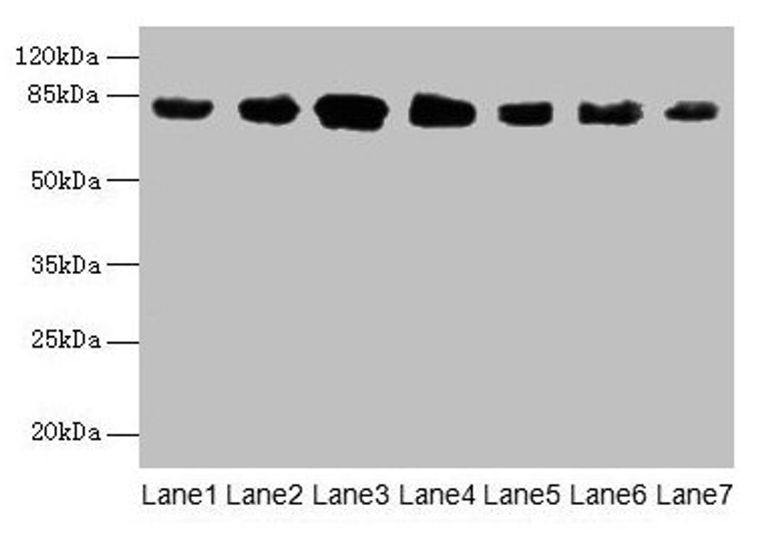 Western blot. All lanes: CLGN antibody at 7µg/ml. Lane 1: Mouse brain tissue. Lane 2: Mouse lung tissue. Lane 3: Jurkat whole cell lysate. Lane 4: HepG2 whole cell lysate. Lane 5: PC-3 whole cell lysate. Lane 6: Hela whole cell lysate. Lane 7: HL60 whole cell lysate. Secondary. Goat polyclonal to rabbit IgG at 1/10000 dilution. Predicted band size: 71, 47 kDa. Observed band size: 80 kDa