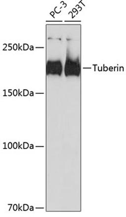 Western blot - Tuberin  antibody (A19540)