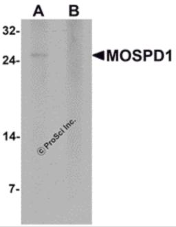 Western blot analysis of MOSPD1 in human brain tissue lysate with MOSPD1 antibody at 1 μg/mL in (A) the absence and (B) the presence of blocking peptide.