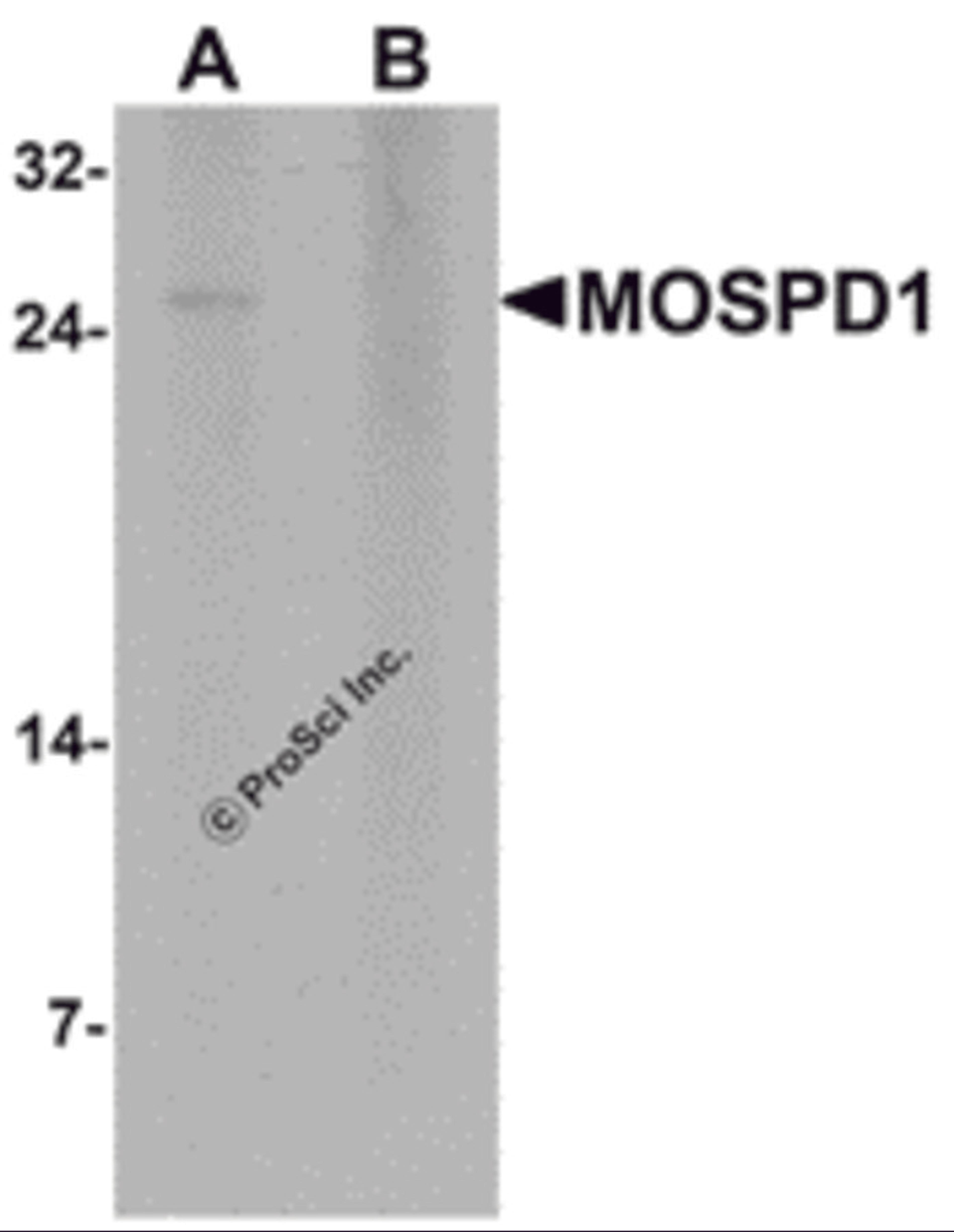 Western blot analysis of MOSPD1 in human brain tissue lysate with MOSPD1 antibody at 1 μg/mL in (A) the absence and (B) the presence of blocking peptide.