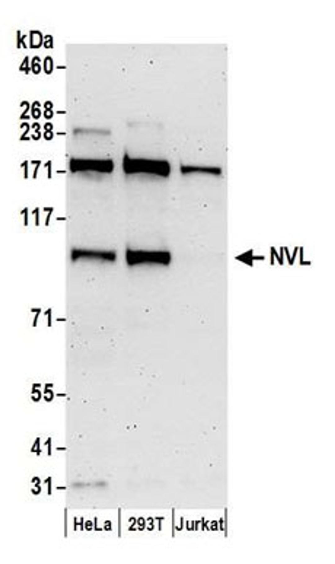 Detection of human NVL by western blot.