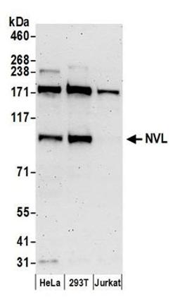 Detection of human NVL by western blot.