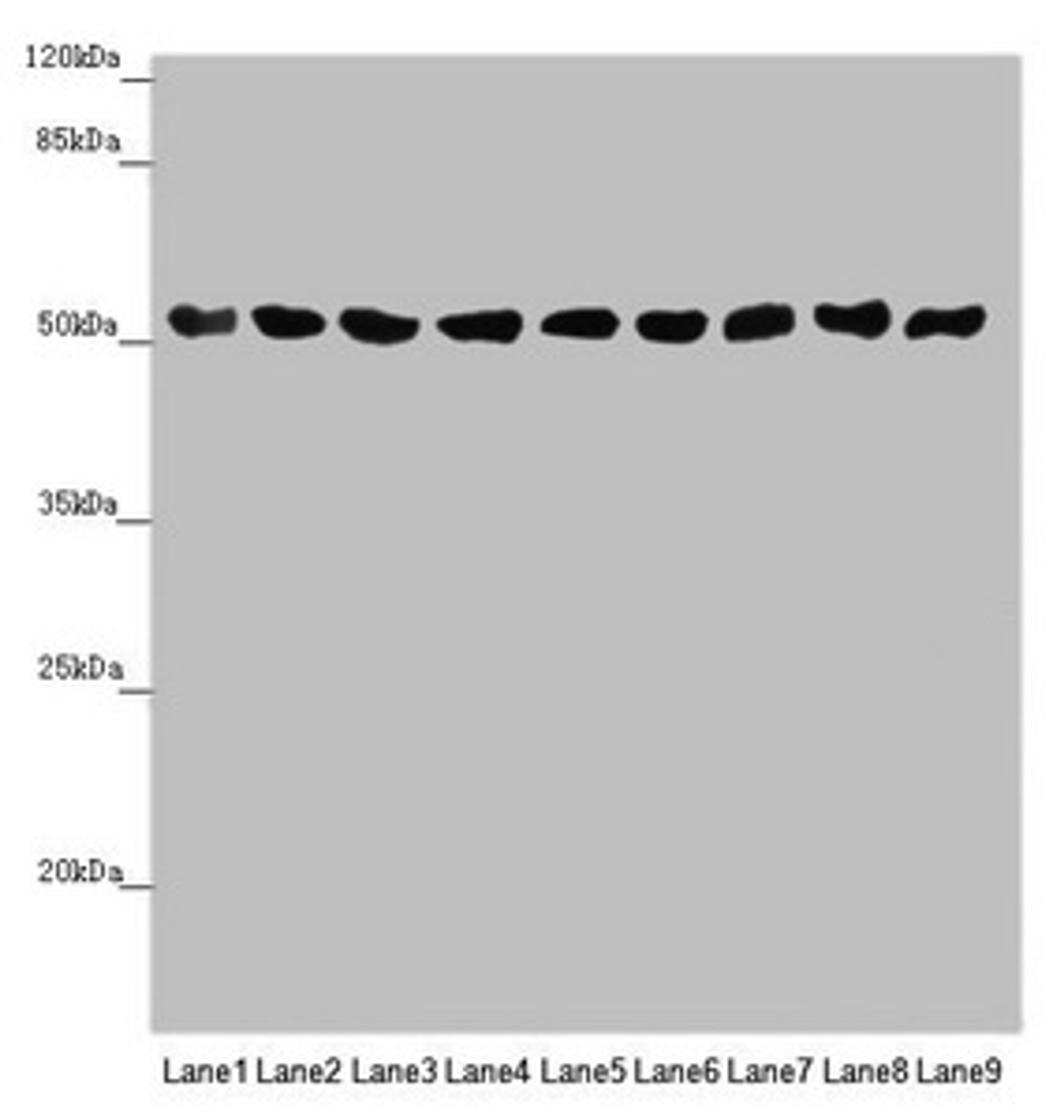 Western blot. All lanes: SAMM50 antibody at 0.98µg/ml. Lane 1: Mouse gonadal tissue. Lane 2: A375 whole cell lysate. Lane 3: A431 whole cell lysate. Lane 4: 293T whole cell lysate. Lane 5: Hela whole cell lysate. Lane 6: A549 whole cell lysate. Lane 7: HepG2 whole cell lysate. Lane 8: U251 whole cell lysate. Lane 9: LO2 whole cell lysate. Secondary. Goat polyclonal to rabbit IgG at 1/10000 dilution. Predicted band size: 52 kDa. Observed band size: 52 kDa