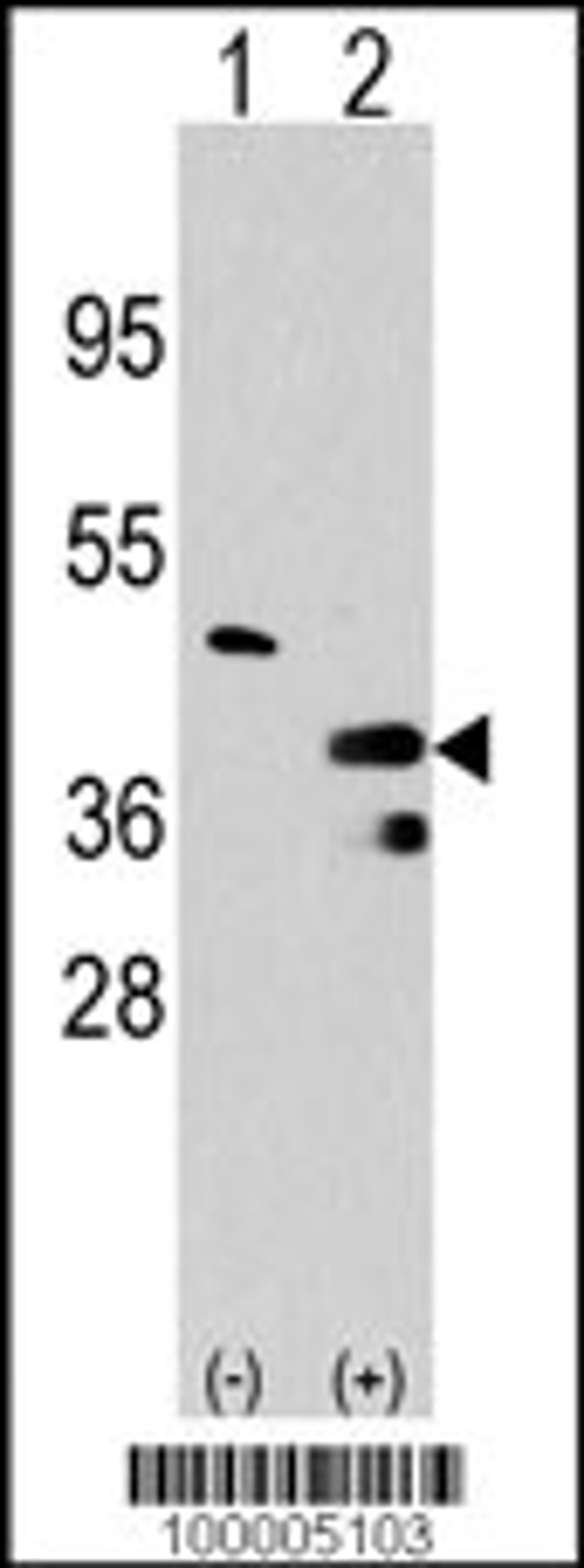 Western blot analysis of PRMT1 using rabbit polyclonal PRMT1 Antibody using 293 cell lysates (2 ug/lane) either nontransfected (Lane 1) or transiently transfected with the PRMT1 gene (Lane 2).