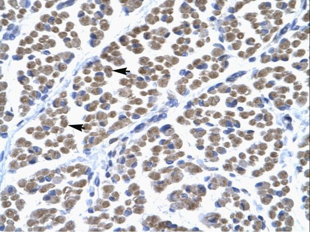 Antibody used in IHC on Human muscle at 4.0-8.0 ug/ml.