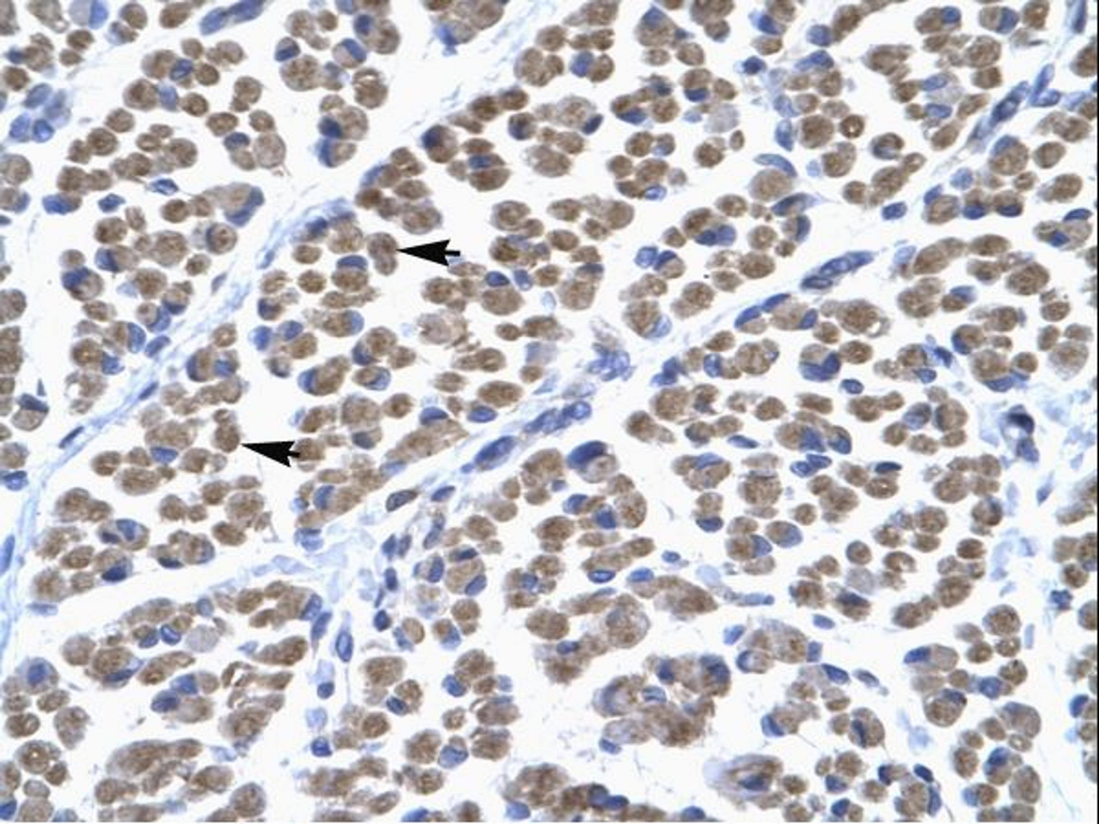 Antibody used in IHC on Human muscle at 4.0-8.0 ug/ml.