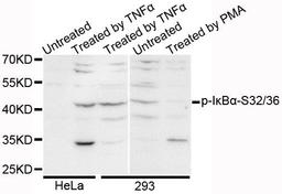 Western blot analysis of extracts of various cell lines using IkBalpha (Phospho-S32/36) antibody