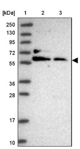 Western Blot: MAZ Antibody [NBP2-33519] - Lane 1: Marker [kDa] 250, 130, 95, 72, 55, 36, 28, 17, 10<br/>Lane 2: Human cell line RT-4<br/>Lane 3: Human cell line U-251MG sp