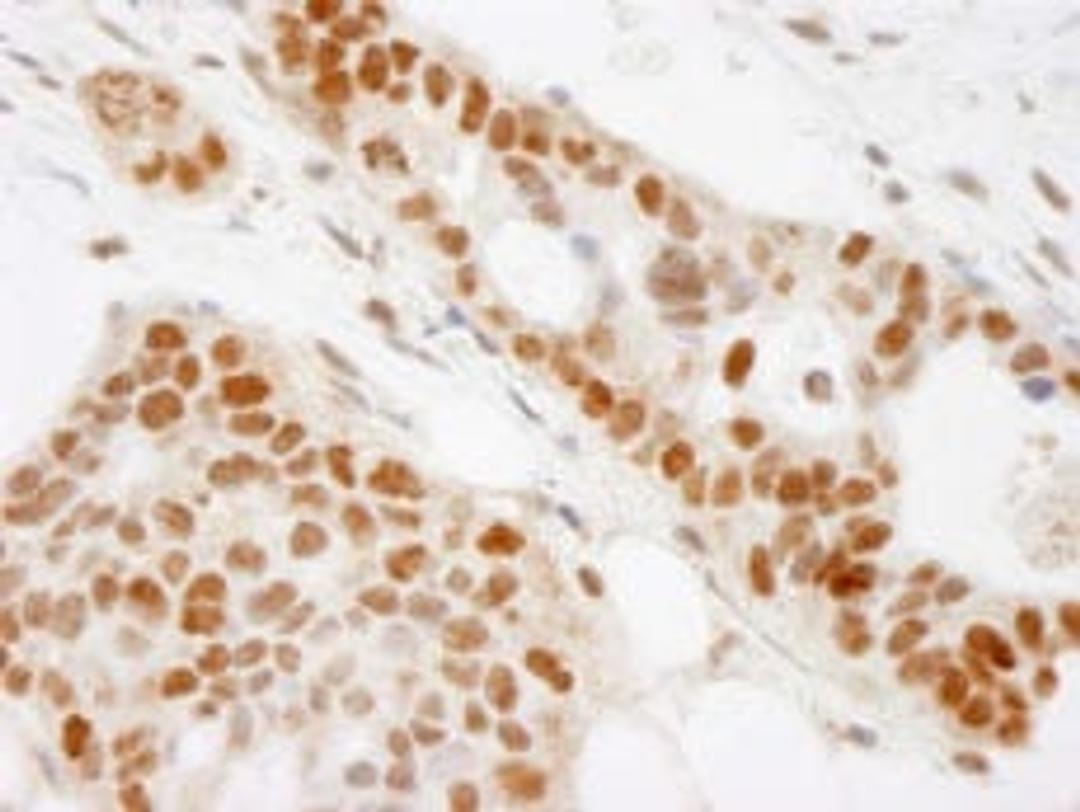 Detection of human BAAT1 by immunohistochemistry.