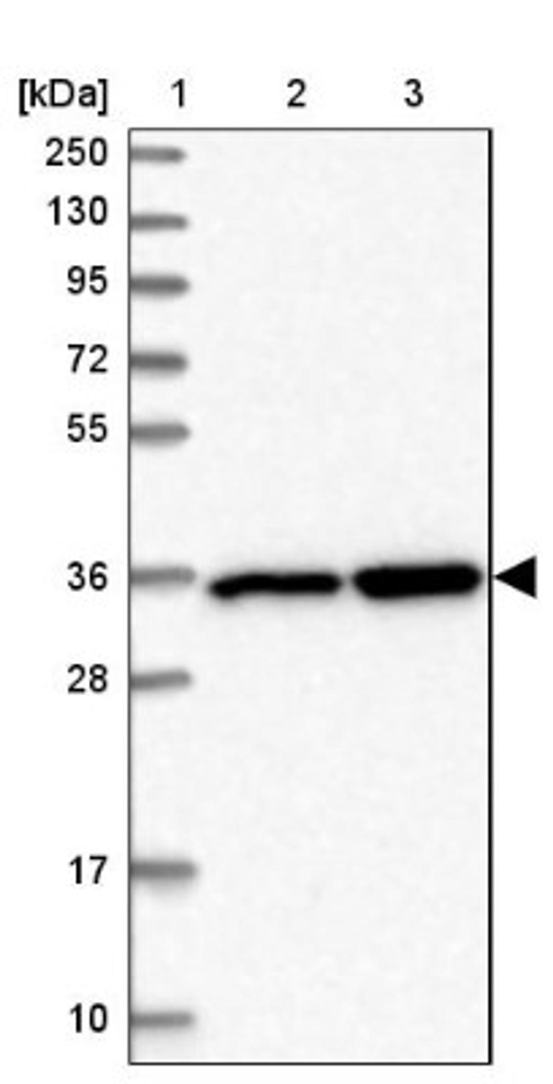 Western Blot: LZTFL1 Antibody [NBP2-47387] - Lane 1: Marker [kDa] 250, 130, 95, 72, 55, 36, 28, 17, 10.  Lane 2: Human cell line RT-4.  Lane 3: Human cell line U-251MG.