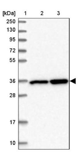 Western Blot: LZTFL1 Antibody [NBP2-47387] - Lane 1: Marker [kDa] 250, 130, 95, 72, 55, 36, 28, 17, 10.  Lane 2: Human cell line RT-4.  Lane 3: Human cell line U-251MG.