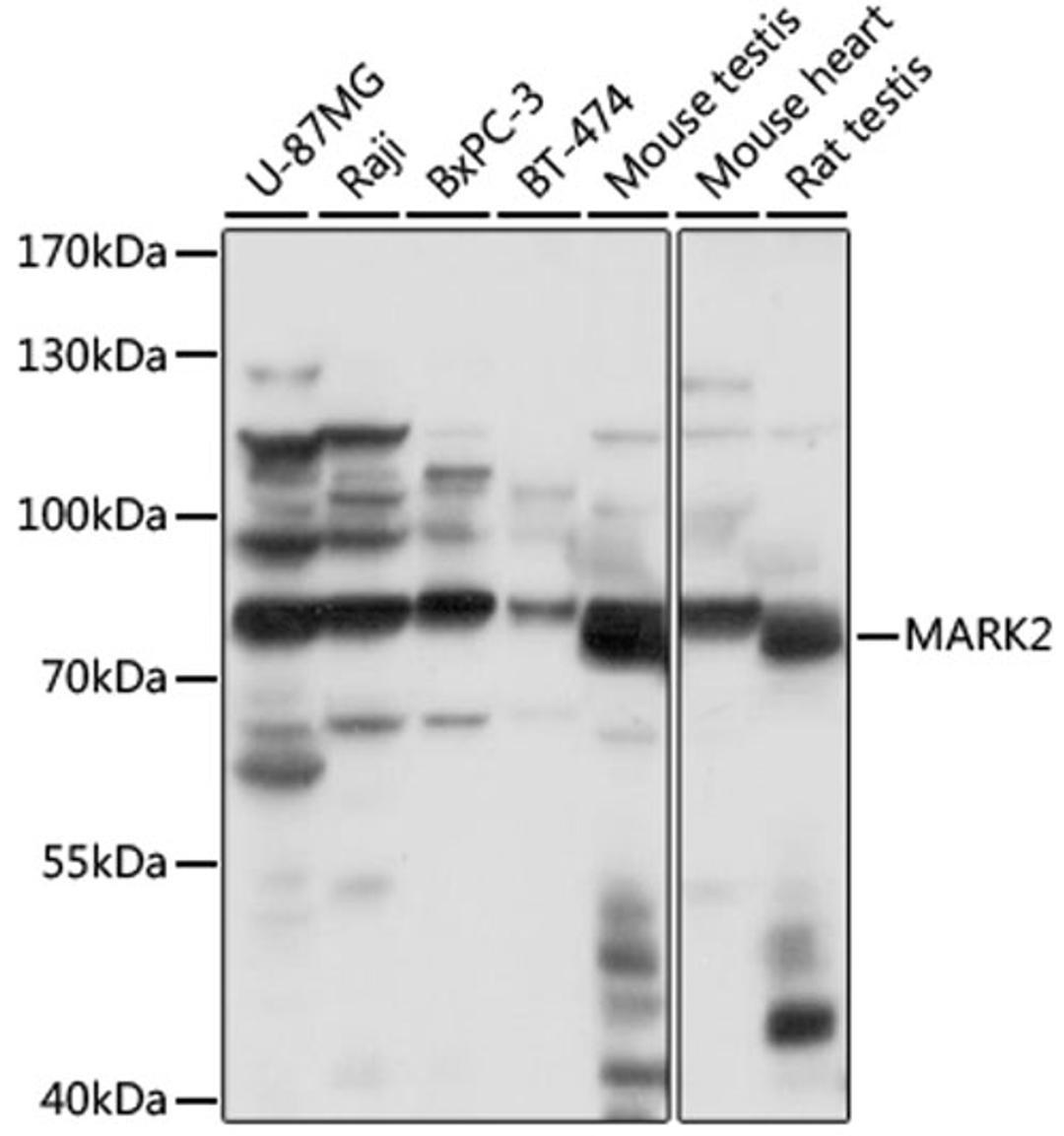 Western blot - MARK2 antibody (A16706)