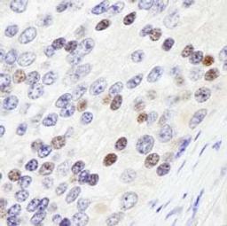 Detection of human ZHX3 by immunohistochemistry.