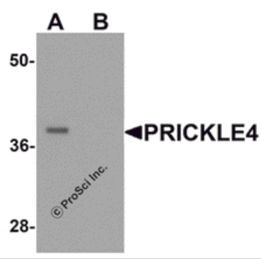 Western blot analysis of PRICKLE4 in A549 cell lysate with PRICKLE4 antibody at 0.25 μg/ml in the (A) absence and (B) presence of blocking peptide.