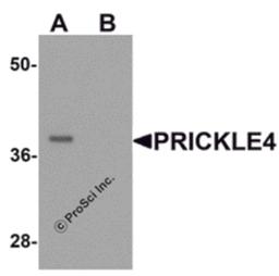 Western blot analysis of PRICKLE4 in A549 cell lysate with PRICKLE4 antibody at 0.25 μg/ml in the (A) absence and (B) presence of blocking peptide.