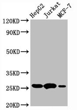 Western Blot. Positive WB detected in:HepG2 whole cell lysate,Jurkat whole cell lysate,MCF-7 whole cell lysate. All lanes:BCL2 antibody at 1&mu;g/ml. Secondary. Goat polyclonal to rabbit IgG at 1/50000 dilution. Predicted band size: 26 KDa. Observed band size: 26 KDa. &nbsp;